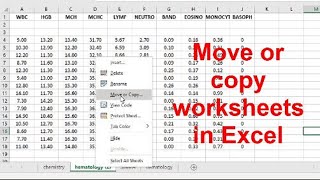 Move or copy worksheets or worksheet data in Excel !!!