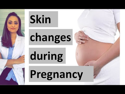 Skin changes in pregnancy | Dermatologist | Dr. Aanchal Panth