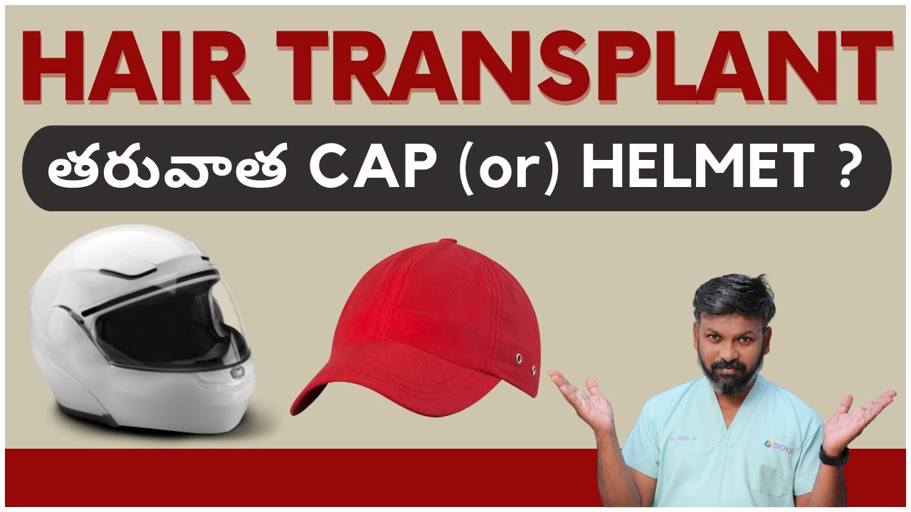 Post Hair Transplant Look  Tips  Tricks  YouTube