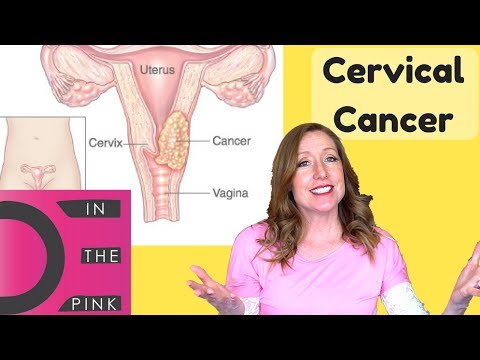 Video: Cervical Cancer - The First Signs, Stages And Treatment