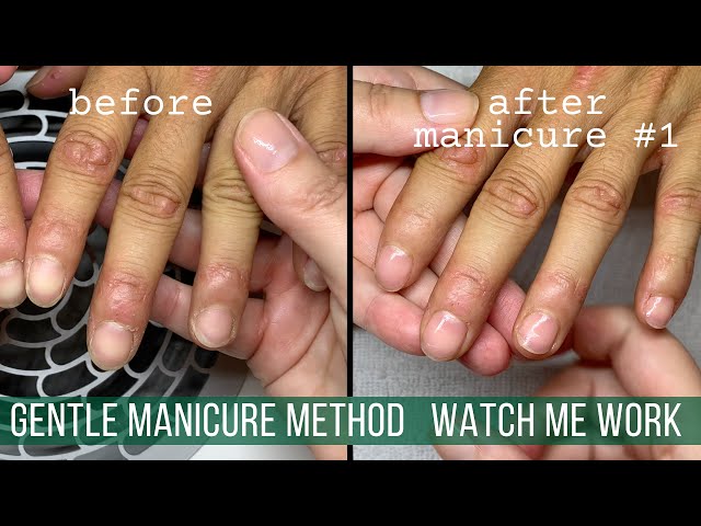 Dry Cuticles and Flaky Skin Around the Nails? An EASY FIX Dry cuticles... |  cuticle removal | TikTok