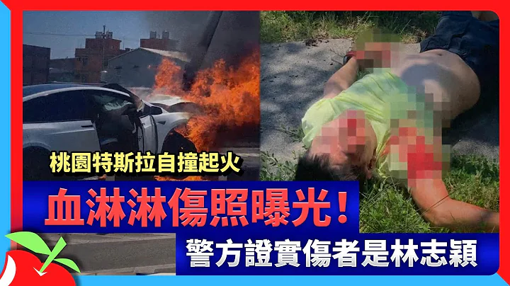 桃园特斯拉自撞起火　血淋淋伤照曝光！警方证实伤者是林志颖 | 台湾新闻 Taiwan 苹果新闻网 - 天天要闻