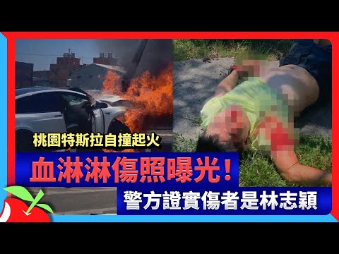 桃園特斯拉自撞起火　血淋淋傷照曝光！警方證實傷者是林志穎 | 台灣新聞 Taiwan 蘋果新聞網