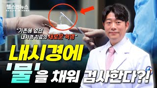 치료 내시경의 다음 단계 &#39;수중 ESD&#39; (김찬호 세강병원 원장)