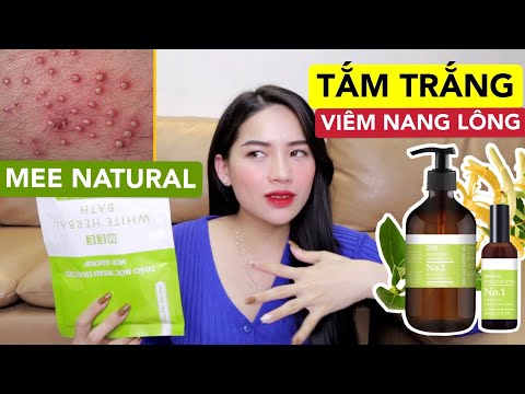 Video [REVIEW] Tắm trắng nhau thai cừu, Sữa tắm & xịt viêm... - youtube
