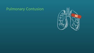 Chest Trauma: Pulmonary Contusion