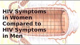 HIV symptoms in women