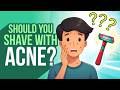 Should You Shave with Acne? Teen Shaving Tips to Avoid Irritation and Breakouts