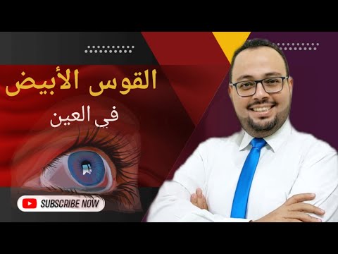 القوس الأبيض في القرنية اللون الأبيض في العين