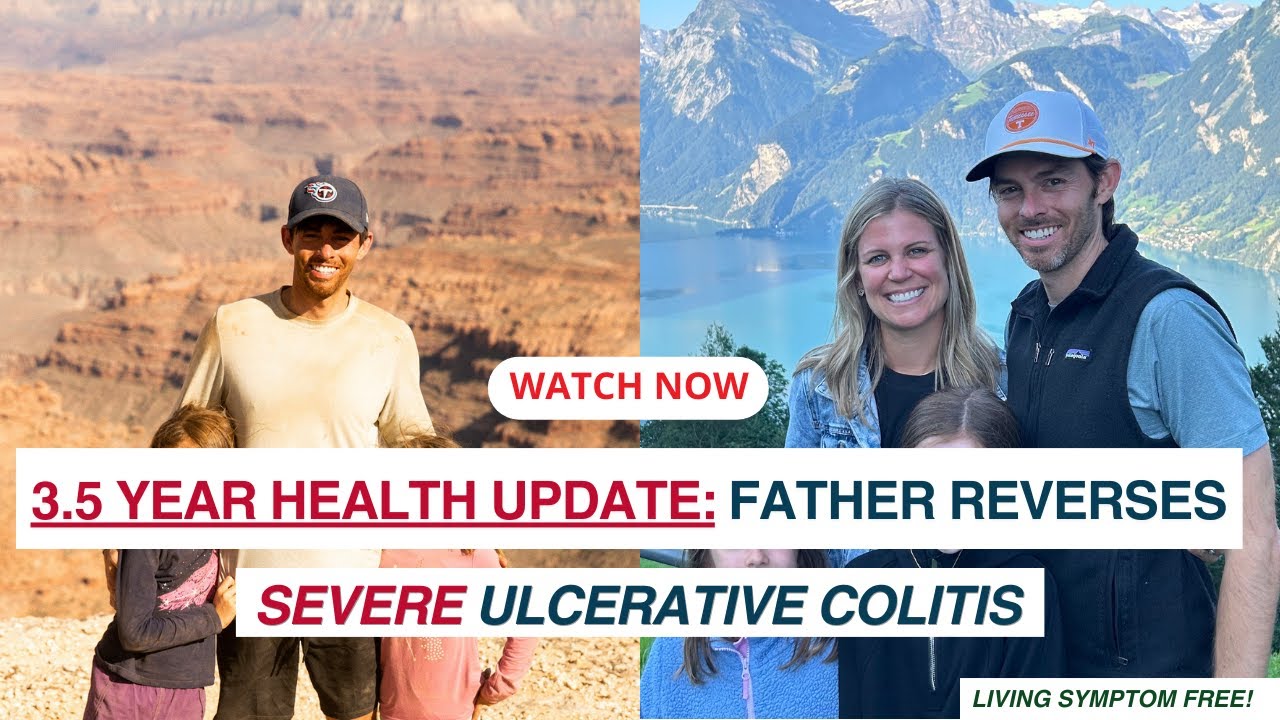 Ulcerative Colitis Remission After 3.5 Years | Marshall’s IBD Success Story