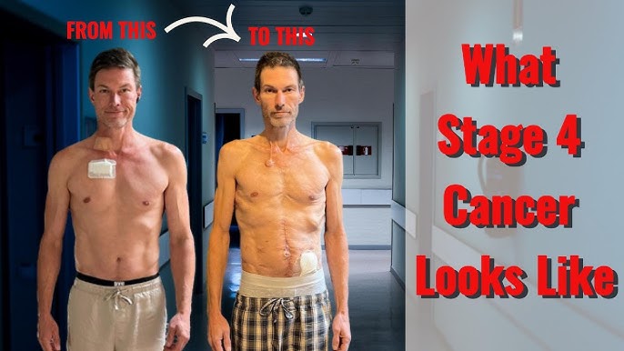 Eng yaxshi jinsiy aloqa pozitsiyalari video Qalin labli trans