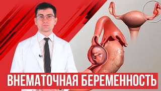 Внематочная беременность. Что делать и какие последствия?