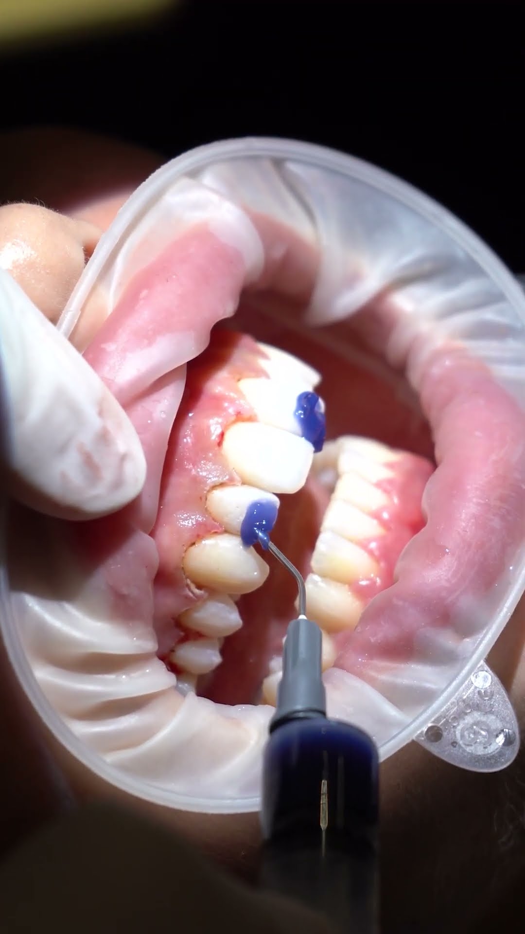 Leodent Dental Klinik — Ağız ve Diş Sağlığı Çözümleri