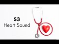 S3 heart sound  medzcool