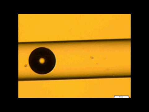 Large Particle Detachment in a Microchannel