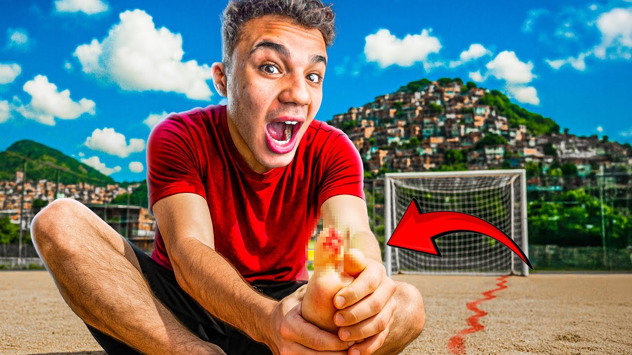 Você Já Arrancou O Tampão Do Dedo?