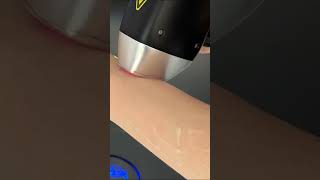 Eosice Max Smart Ice Cool Pain Free