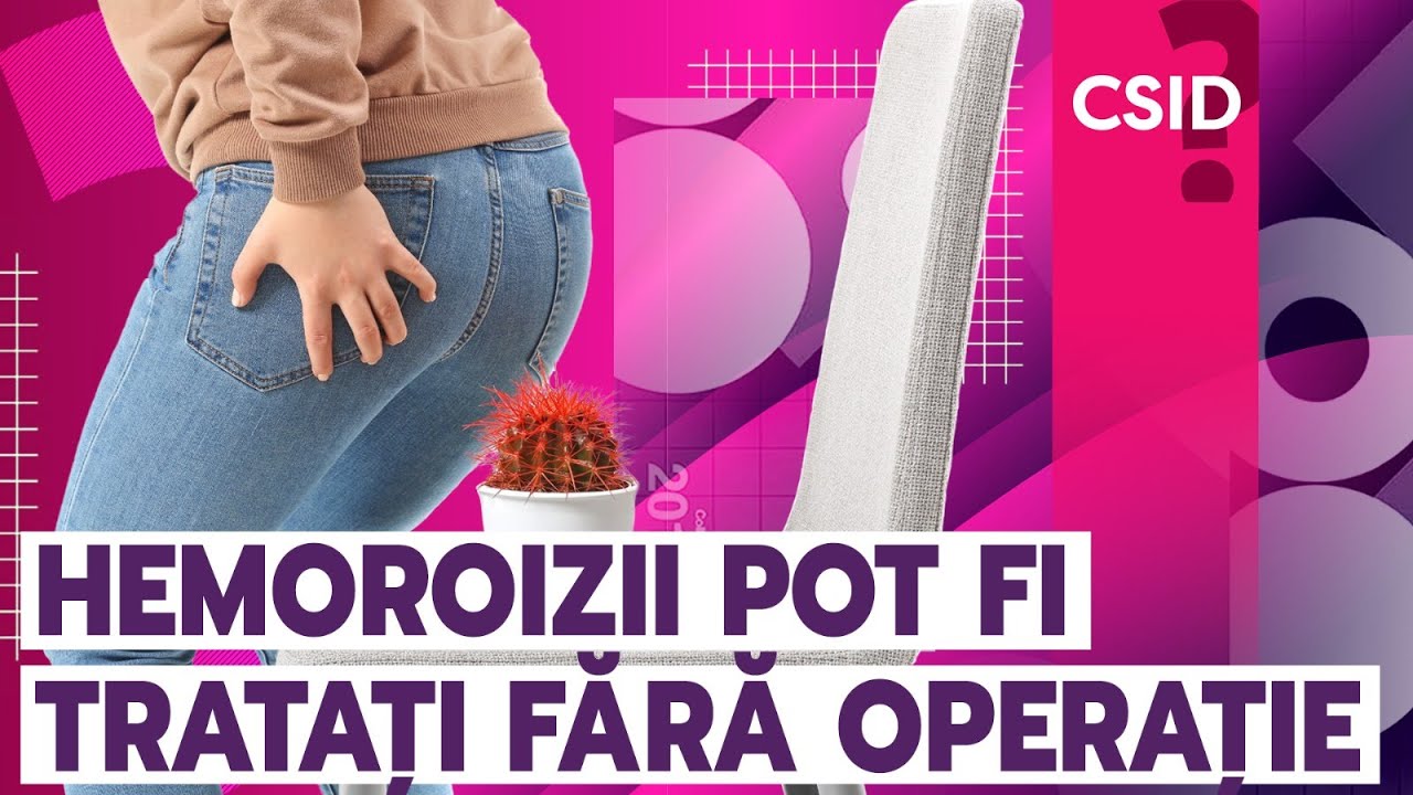 Hemoroizi: cum se tratează fără operație