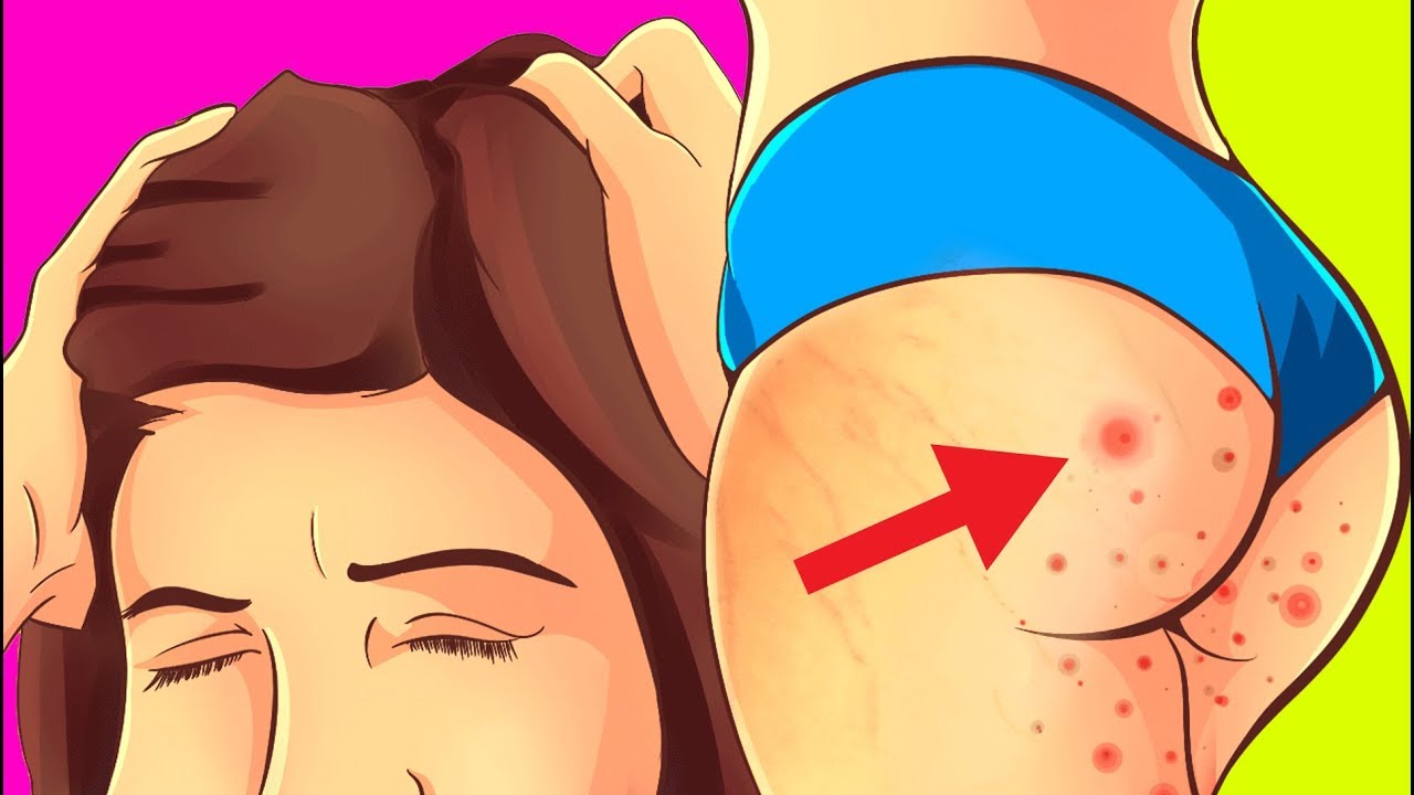 videos de belleza para el cabello 8 SORPRENDENTES Usos de la Aspirina que NO CONOCÍAS | Lina Mechaz
