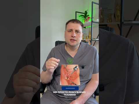 Лапароскопія vs Лапаротомія — чому біль менший | Dr. Terekhov