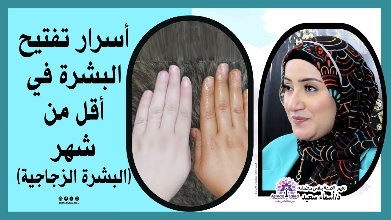 عرفت أفتح بشرتي بهذه الوصفة فقط ( ستدهشك النتيجة )