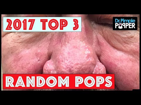 Dr Pimple Popper's Top 4