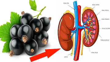 Are black currants high in sugar?