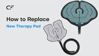 Cryoforce Pad Replacement