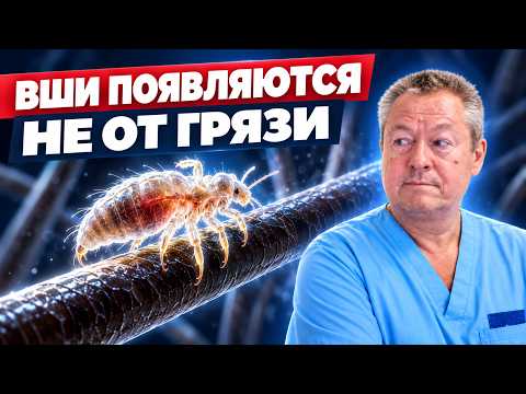 Where do lice actually come from? The whole truth about parasites