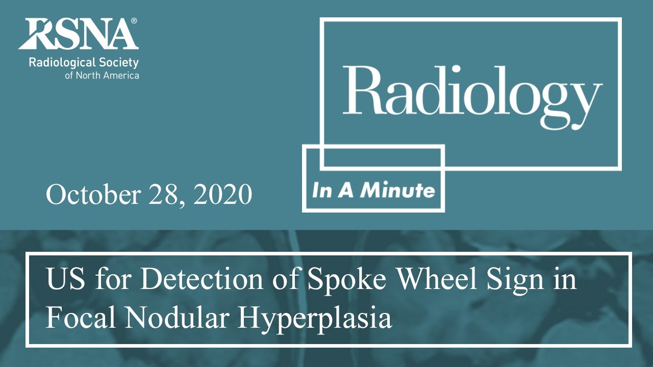 US for Detection of Spoke Wheel Sign in Focal Nodular Hyperplasia (Gastrointestinal) YouTube