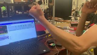 EMG Muscular Signal Sensor with Microbit