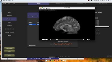 UMass Amherst CONN Workshop, Part 3: Preprocessing