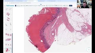 Avi Bitterman Dermpath Lecture 2