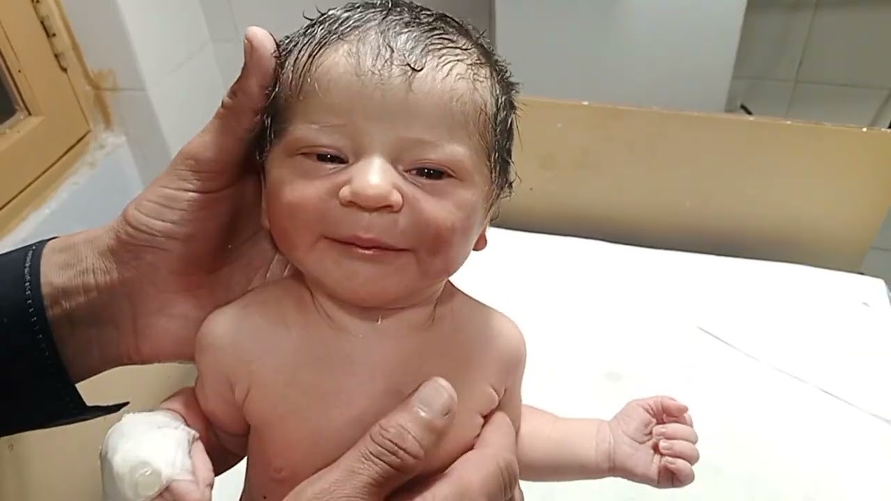 Newborn Baby Discharged in Healthy Condition | Feeding Well After Treatment. 