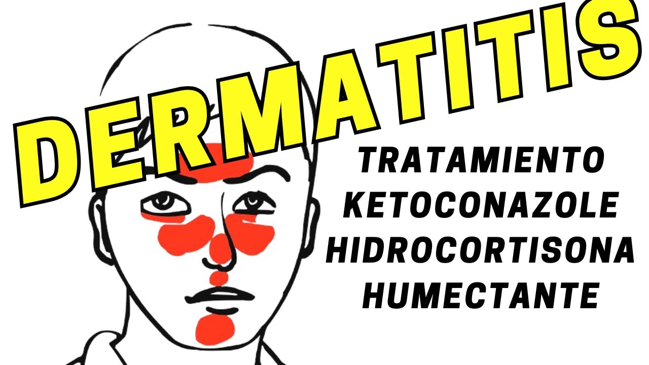 El tratamiento de la dermatitis seborreica YouTube