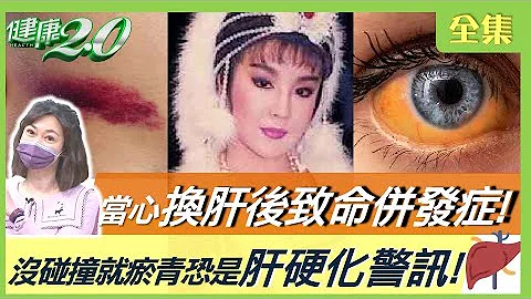 連明月換肝突心臟積水逝世！當心致命併發症！防心包膜發炎！沒碰撞就瘀青、魚際紅斑恐是肝硬化警訊！薺菜降三酸甘油酯！健康2.0 20230305【完整版】鄭凱云 范泉山 張兼華 陳潮宗 梁惠雯 林秋香 - 天天要聞