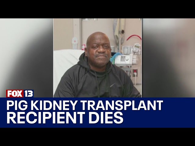 1st pig kidney transplant recipient dies