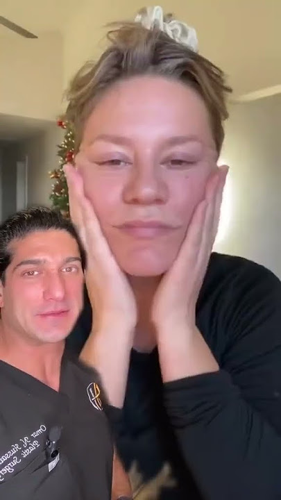 Plastic Surgeon Reacts to Face Tape