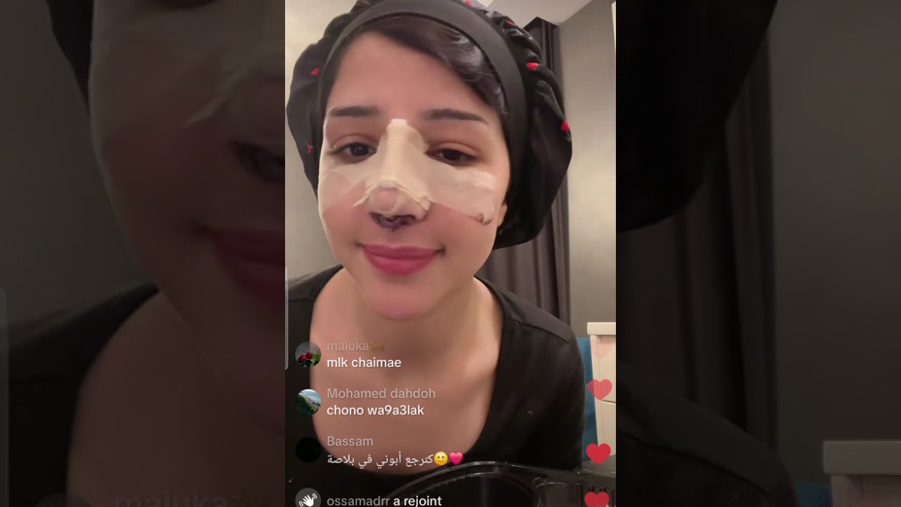 شيماء  دارت عملية تجميل للأنف ديالها و تحكي معاناتها في المطار