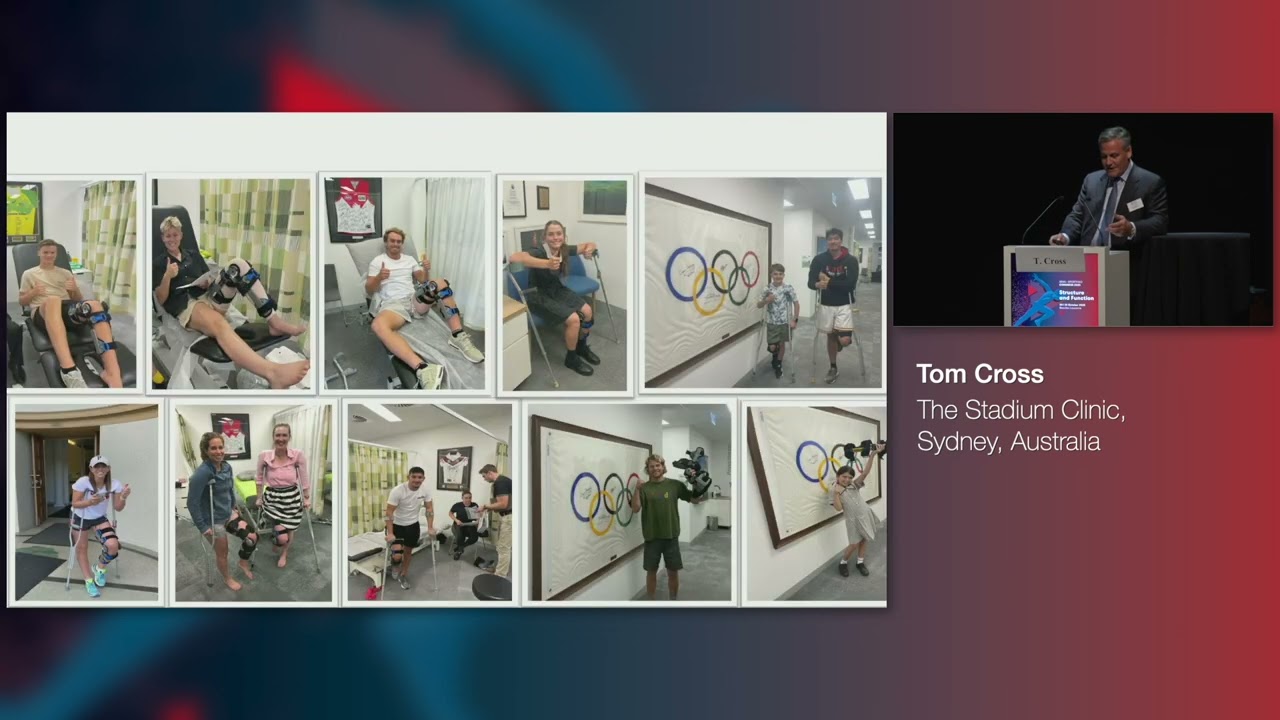 day 1_  Tom Cross _ The ACL cross bracing protocol