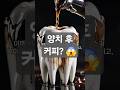 양치 후 바로 커피 마시면 절대 안 되는 이유! 치아 건강을 망치는 최악의 습관