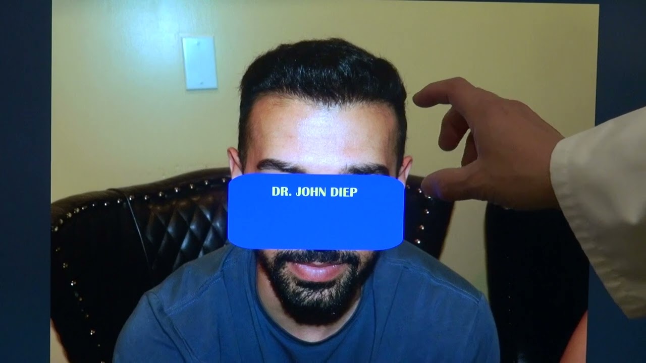 Hair Loss Treatment for Men | [Type of transplant] (# Hair grafts)