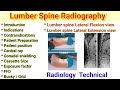 Lumber spine radiography  lateral flexion view  extension view radiography radiology