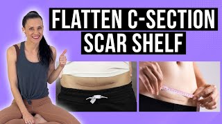 Do This To Your C-Section Scar EVERY DAY To Flatten\/Prevent C-Section Scar Shelf