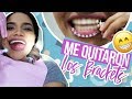 ME QUITARON LOS BRACKETS! 😁 mira el paso a paso 😱 + SÚPER SORTEO