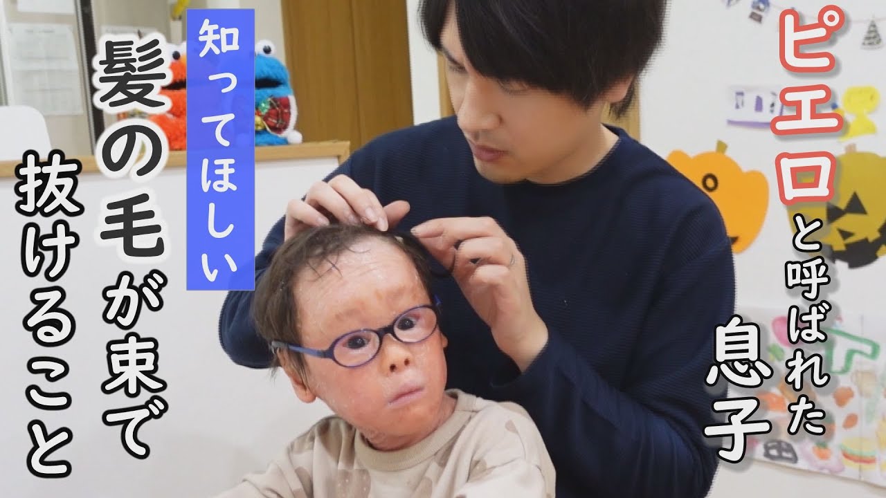 見た目が変わってしまう魚鱗癬の症状…5歳児はどう受け止める?~定期配信型ドキュメンタリー「ピエロと呼ばれた息子」第77話 YouTube 見た目が変わってしまう魚鱗癬の症状…5歳児はどう受け止める?~定期配信型ドキュメンタリー「ピエロと呼ばれた息子」第77話 YouTube