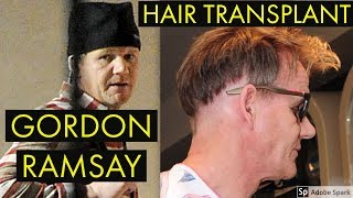 OMG CHEF GORDON RAMSAY HELL'S KITCHEN HAIR TRANSPLANT!