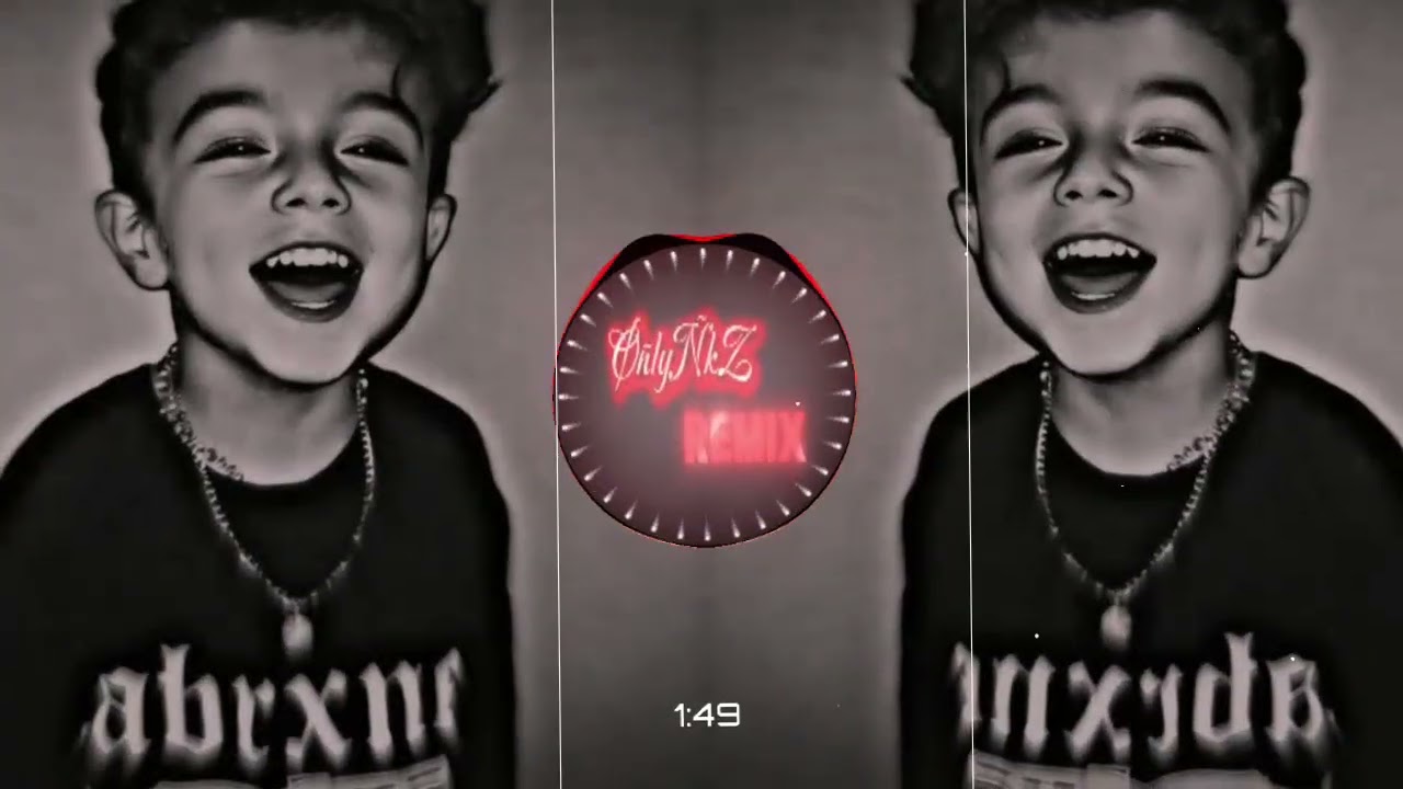 Do You Hear Me - Deep Turkish Music  🥺💔 ( Tiktok Remix) 