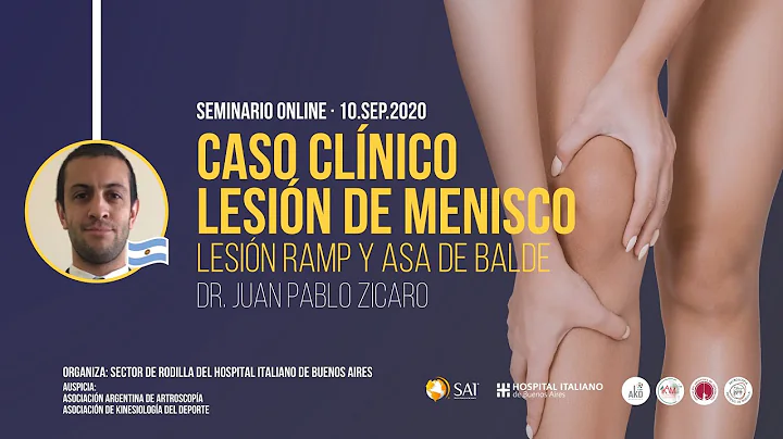 Caso clnico. Lesin RAMP y Asa de balde. Dr. Juan P...