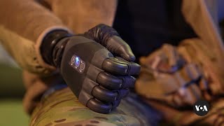 Ukrainian Soldier Gets Bionic Arm Made Using Swedish Technology Voa News
